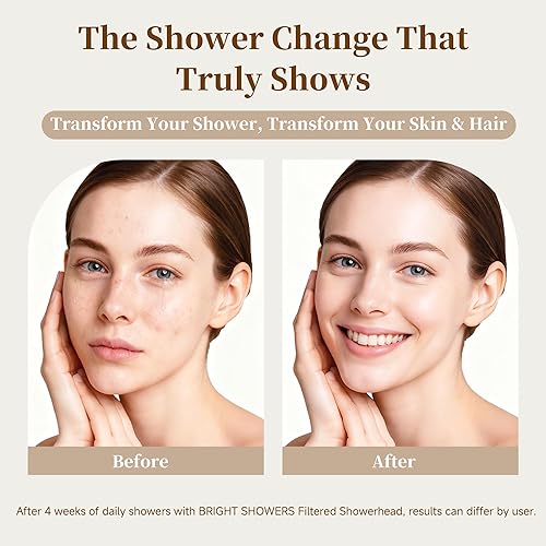 Miniatura 4 de BRIGHT SHOWERS Cabezal de ducha filtrado, cabezal de ducha fijo de alta presión para agua dura, filtro de doble medio que elimina el cloro y las