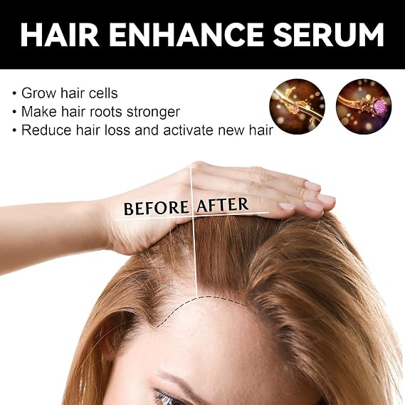 Sumax Folix22 Hair Growth Serum, Natural Oil Blend for Thicker, Fuller Hair, Repairs Dry and Damaged Hair, Unisex Adults, 1PCS