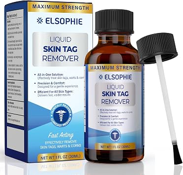 Fast-Acting Skin Tag Remover Freeze Off Maximum Strength Skin Tag Removal Freeze Away for Men and Women - Plantar Wart Genital Wart Corns Calluses 1 oz