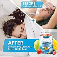 Vista 4 de softbear Sugar Free Potassium Magnesium Gummies for Adults Kids, High Absorption Potassium Supplement Gummies Supports Leg Cramps & Muscle & Immune