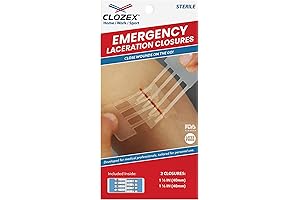 Derma Bond: Revolutionary Skin Closure System