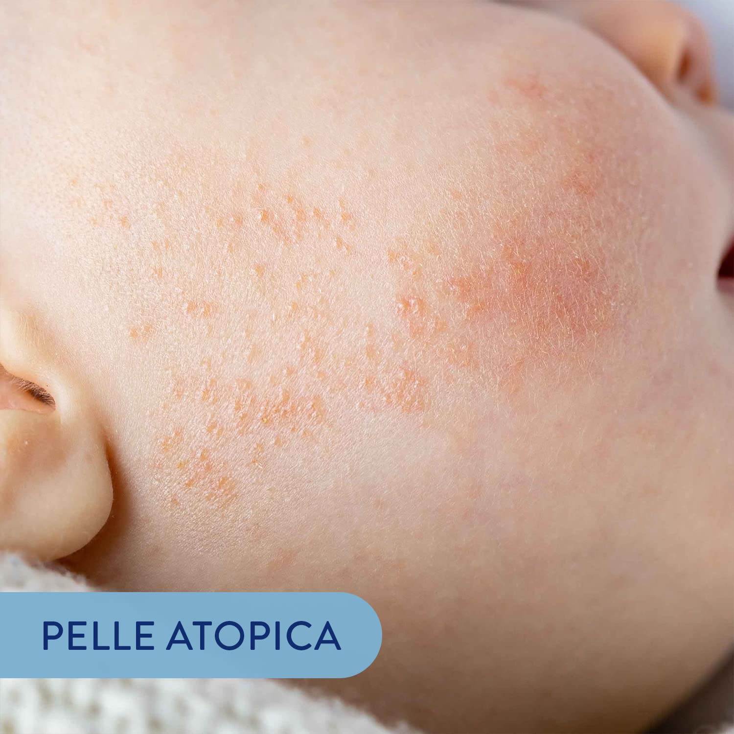 Babycoccole DERMO OLIO DA BAGNO per Bambini e Neonati. Per Pelle Sensibile e Dermatite Atopica. Delicato, Idratante, Protettivo, con Ingredienti Puri e Naturali. Dermatologicamente Testato. 150ml