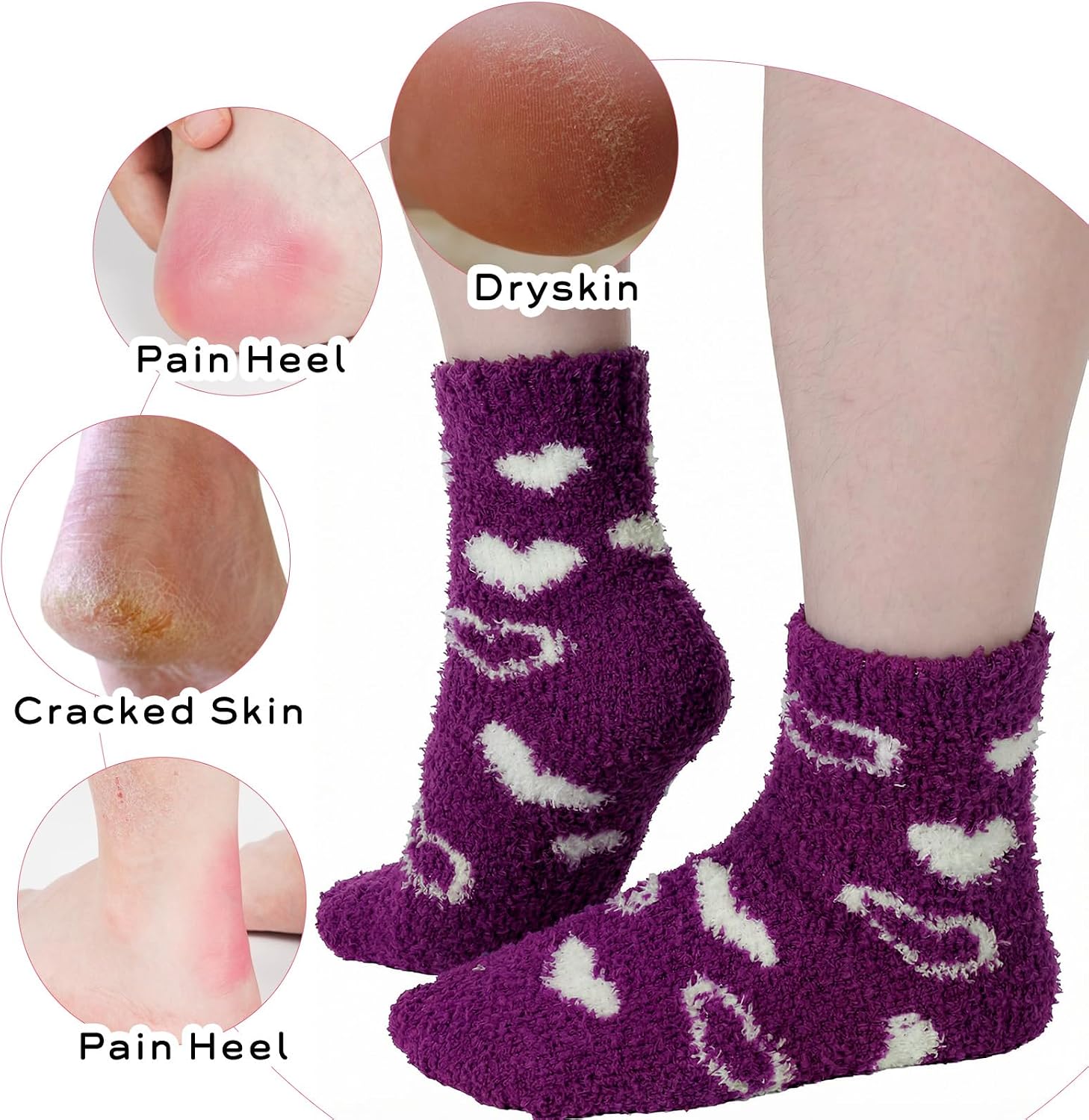 3 Pairs Moisturizing Socks Overnight, Love Heart Aloe Socks, Moisturizer Sock for Dry Cracked Feet, Cozy Gel Spa Sock for Women(White, Dark Purple and Light Blue)