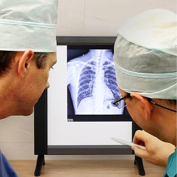 X-ray Film Illuminator Light Box, X-Ray LED Viewbox, X-Ray Viewer Light Panel for Hospital X-Film or CT-Film Lab Equipment(19x20in/48x50.5cm)