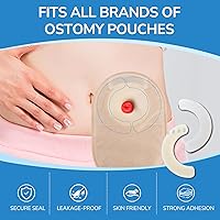 Vista 7 de 20 tiras de barrera para ostomía, tiras de barrera hidrocoloide para la piel, tiras de barrera elástica para bolsa de ostomía, suministros