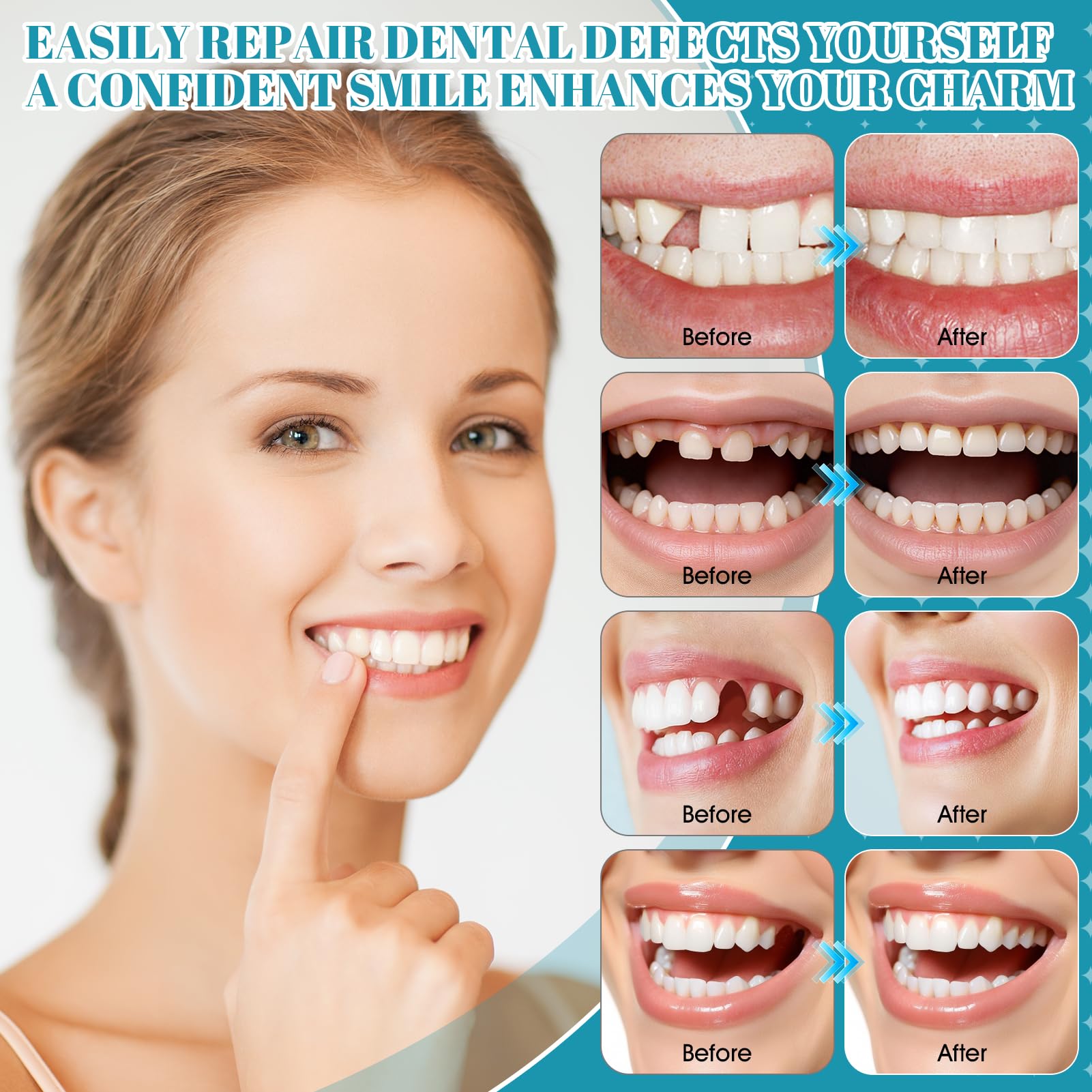 Cement dentystyczny, trwały, klej do zębów, do koron, protez zębowych, roztwór do koron, mostków, próchnicy zębów i zagubionych wypełnień