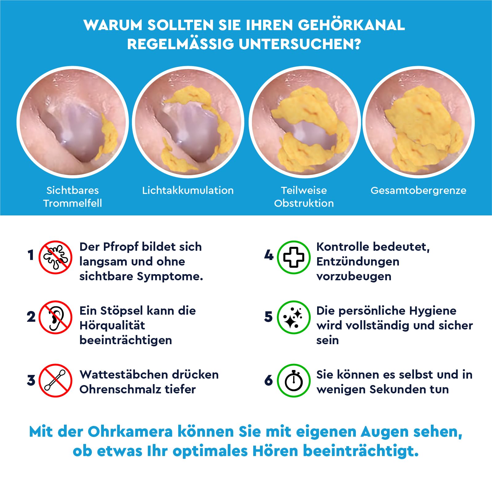 Ohrenschmalz Entferner Otoskop 10MP-HD-Kamera WiFi Flexibler Digitaler Ohrreiniger UdiGuard Pro-Clean Ohrenspiegel mit Pinzette und Austauschbaren Spitzen - Erwachsene und Kinder Hals-Nasen-Ohren-Set