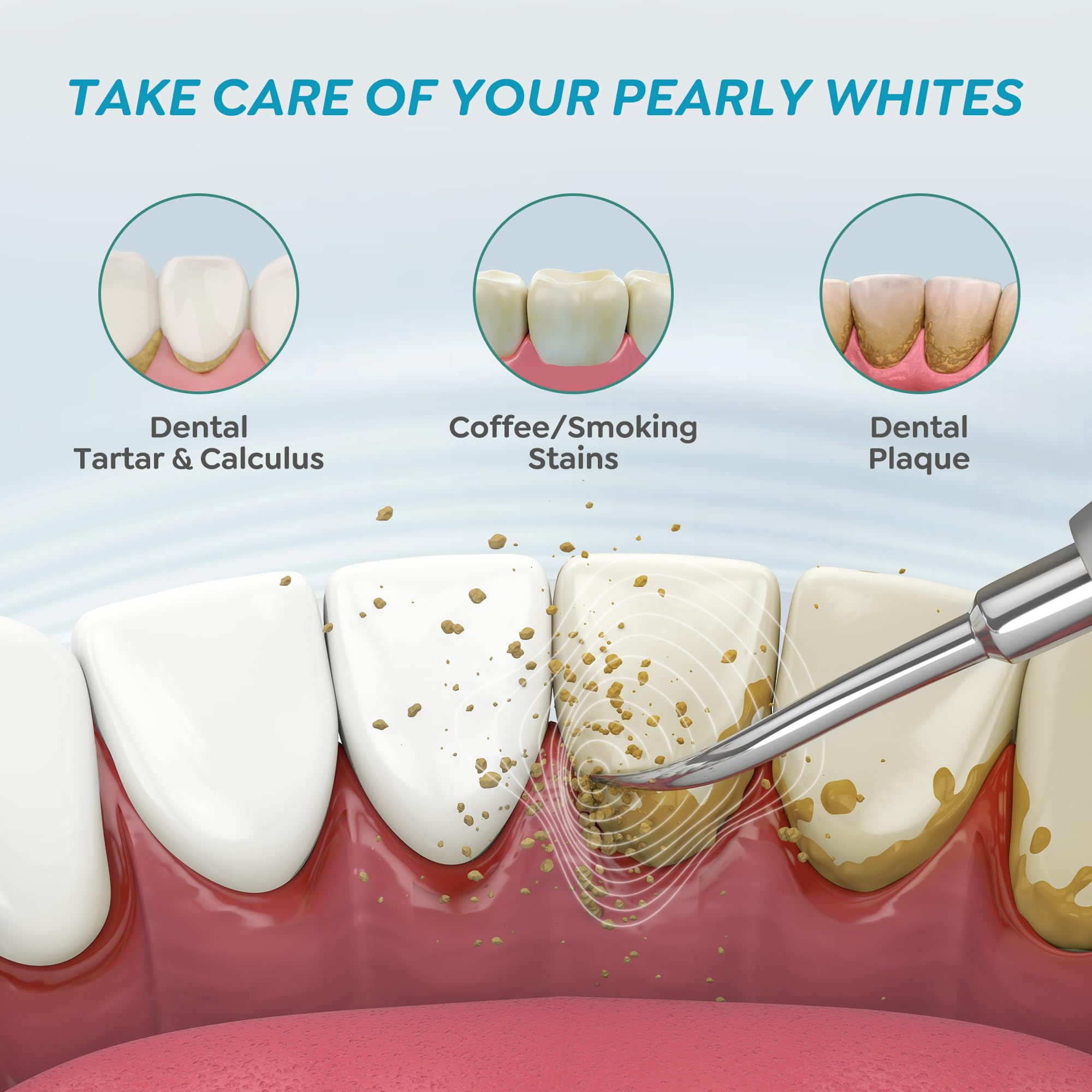 kit Detartrage dents | Brosse à Dent Élimine 99% du Tartres et Plaques | Détartreur Oral et Blanchiment Dentaires | Hygiène Dentaire Haleine Fraiche Hydropulseurs et Irrigateurs