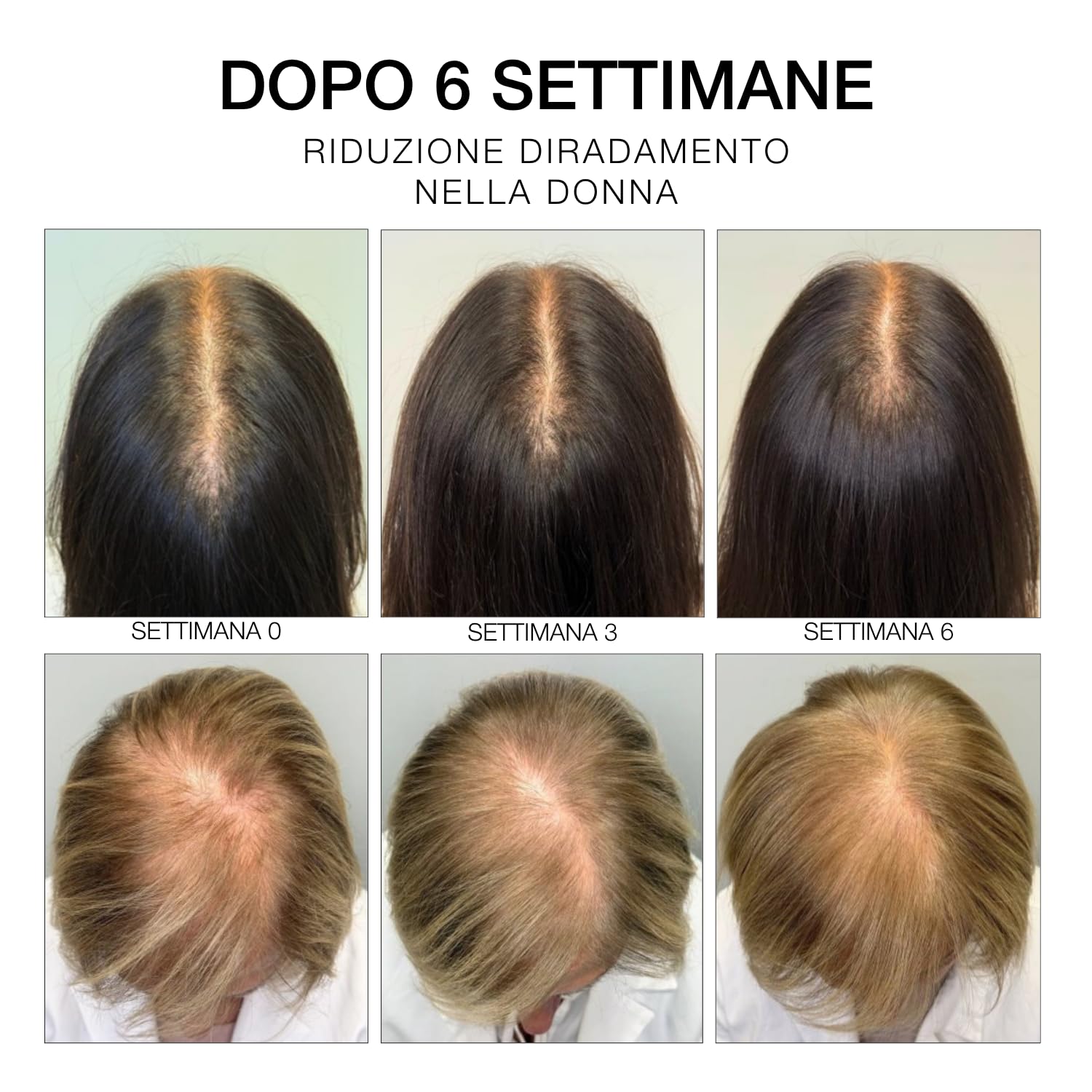 Diego dalla Palma ESTREMIRIMEDI Siero 6, Trattamento Fortificante Scalpo e Capelli, Stimolante del Microcircolo, Rinforzante della Fibra Capillare, 50ml