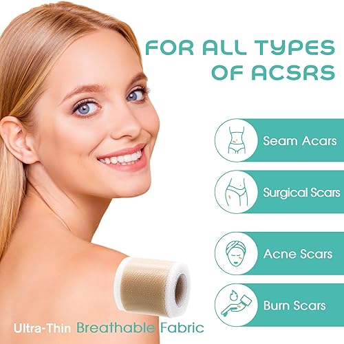 Miniatura 2 de Cinta de silicona suave de grado médico para eliminación de cicatrices (1 x 120 pulgadas), 1 rollo de 70.9 in con hojas de cicatriz de silicona de