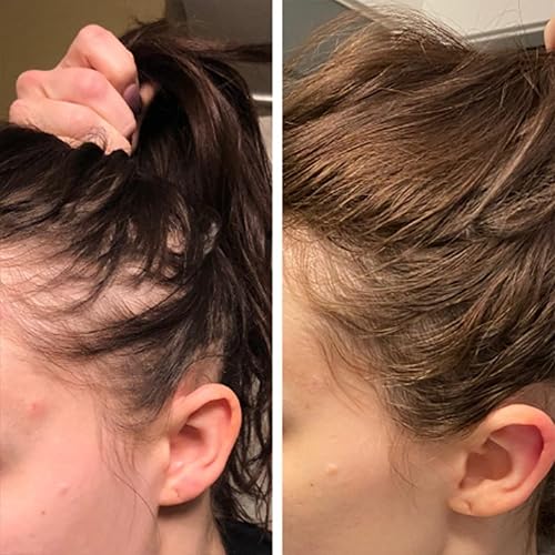 Miniatura 8 de Biotin - Suero para el crecimiento del cabello para el tratamiento de la pérdida y el crecimiento del cabello, aceite esencial de jengibre natural