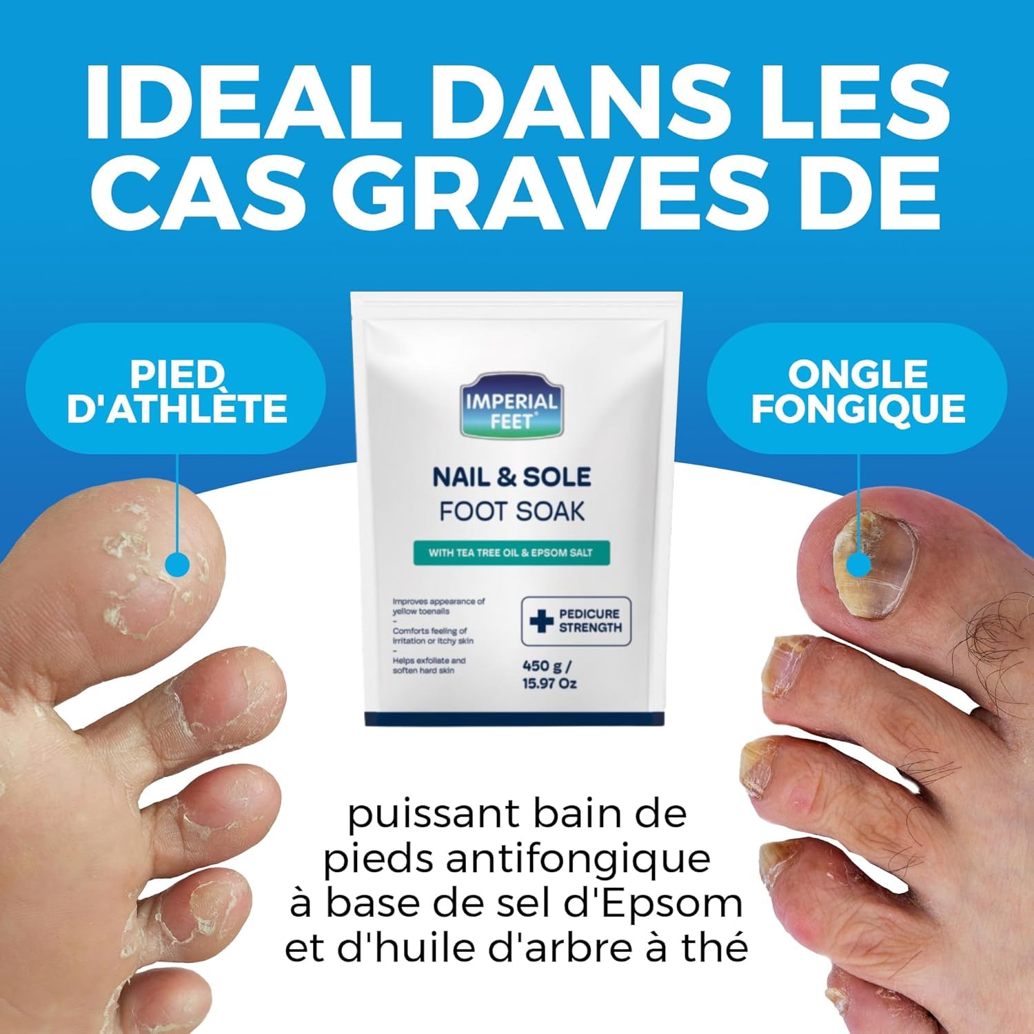 Pedicure Quality Foot Soak with Tea Tree Oil & Epsom Salt | Helps Treat Nail Fungus Athletes Foot | Anti Fungal Nail Treatment | Foot Moisturiser & Deodorizer Feet Soak | Exfoliating Foot Soak