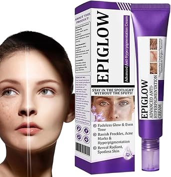 Epiglow Melanex Advanced Cream, 20g Epiglow Melanex Anti Hyperpigmentation Cream, Melasmas Hyperpigmentation Treatments for Face, Antiaging Pigmentation Face Dark Spots Creams, for All Skin Types