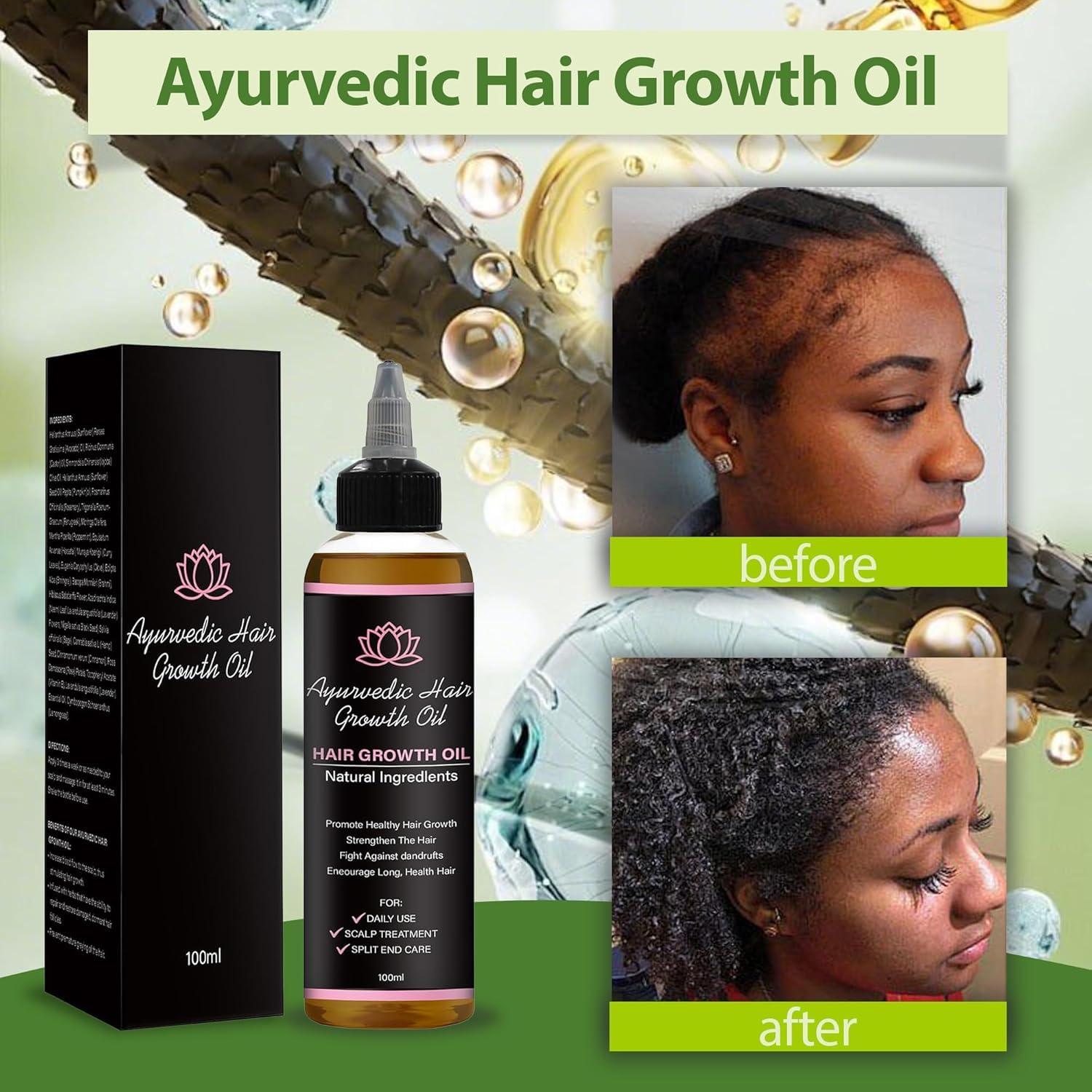 Lifewithqueenp Hair Care Growth Oil, Ayurvedic Hair Growth Oil, Lightweight Natural Herbs Scalp Oils for All Hair Types (1) - Image 3