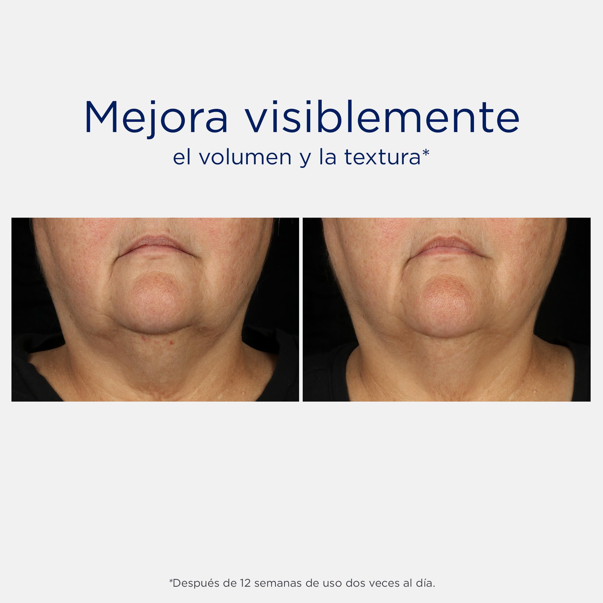 Neostrata Skin Active Tri-Therapy Lifting Serum (1 x 30 ml), sérum facial con efecto voluminizador e iluminador, sérum ácido hialurónico reafirmante, para una hidratación profunda