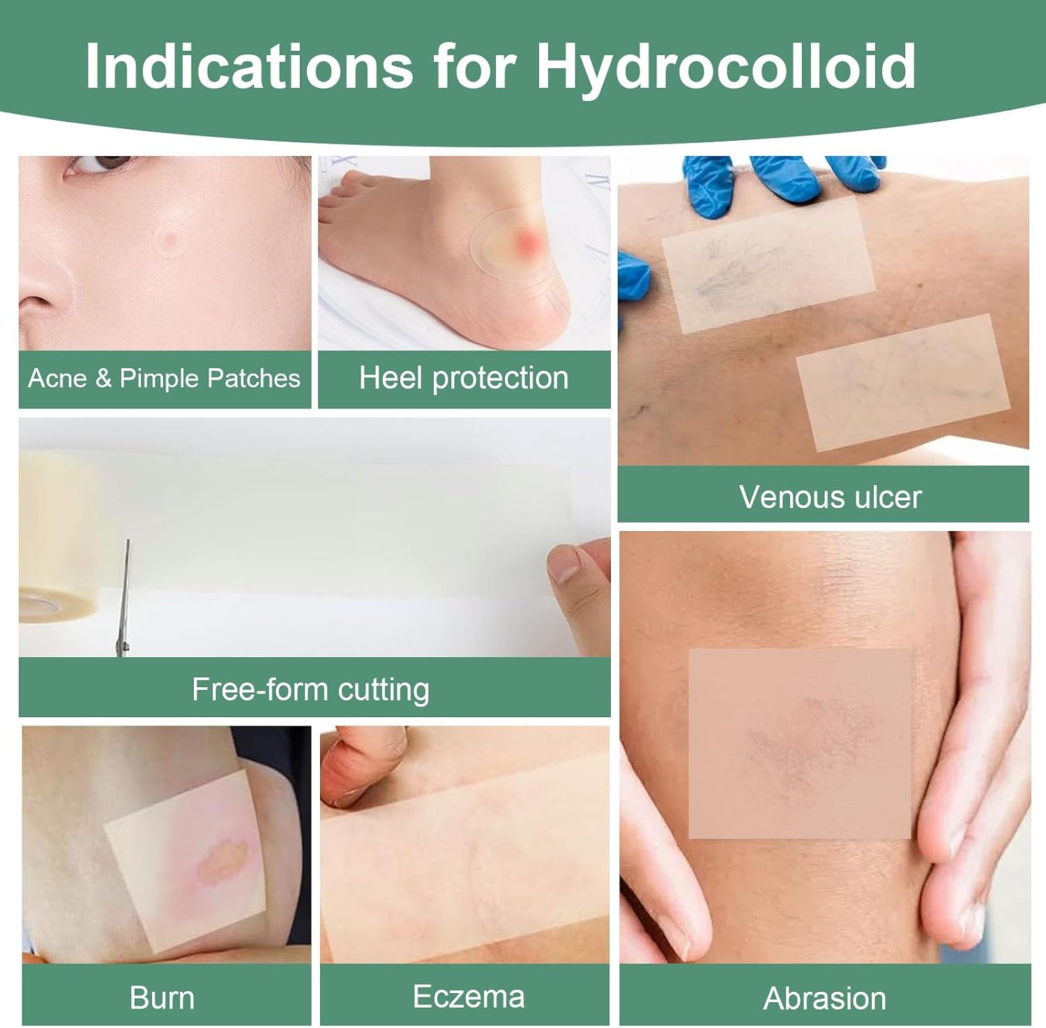 Hydrocolloid Dressing Roll Collection – Gentle Skin Protection for Minor Cuts, Scrapes & Irritations, Latex-Free, Cut-to-Fit Design for Sensitive Skin (2in*4.9ft)