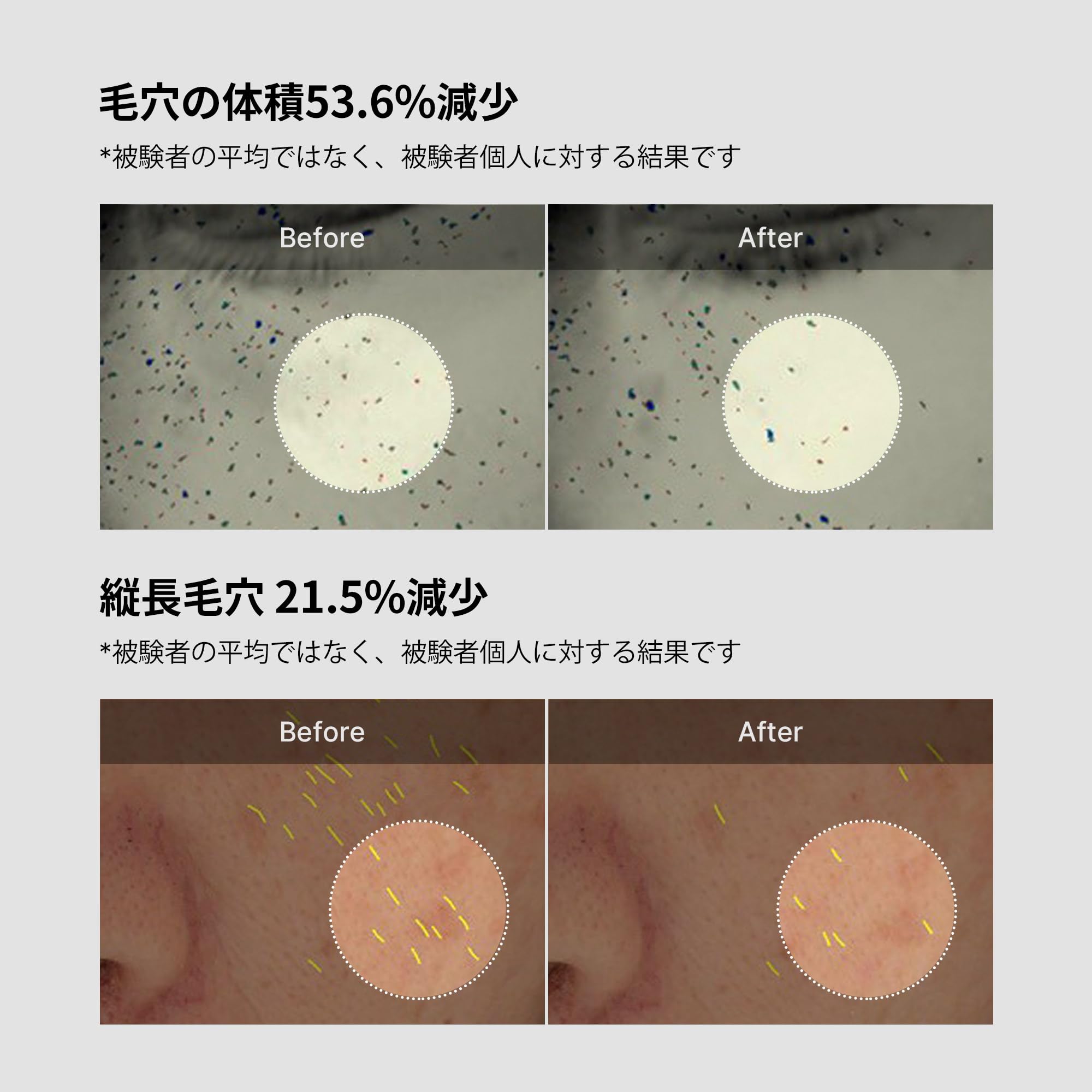 Amazon | メディキューブ ゼロ毛穴ワンデークリーム 50ml 角質ケア 