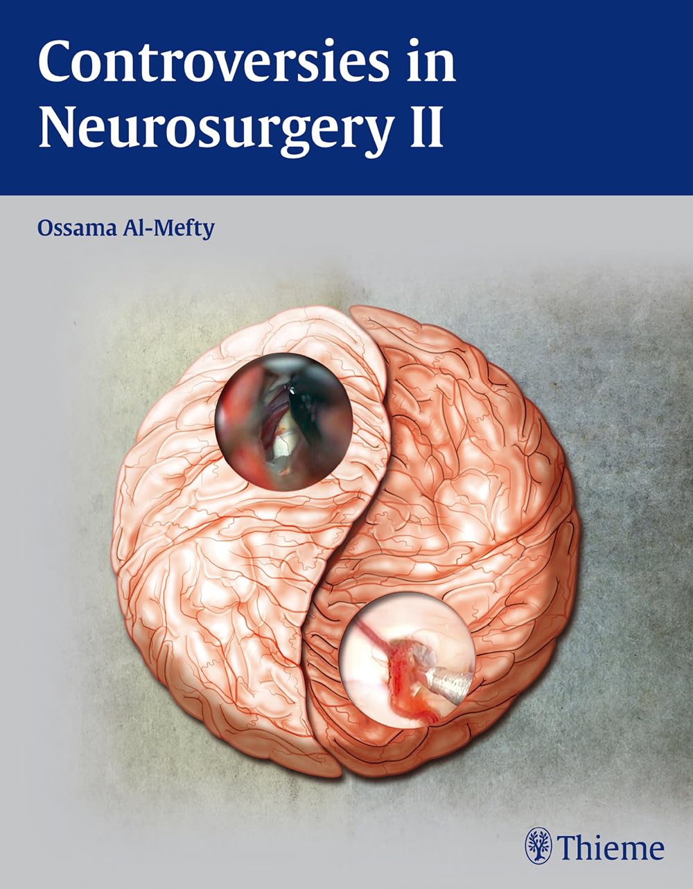 Buy Controversies in Neurosurgery 2 — BookShops.in