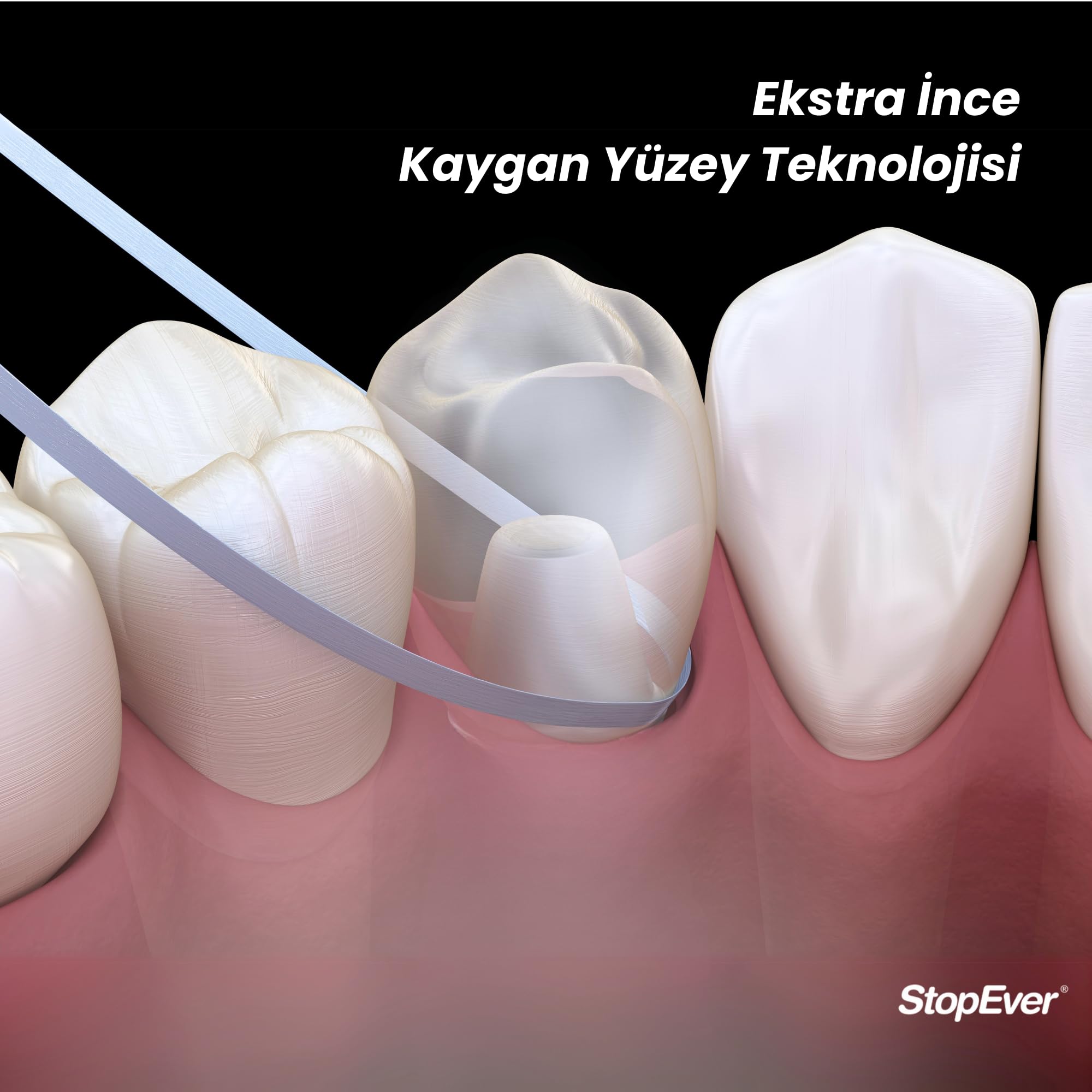 StopEver Smiley Diş İpi 2'li Paket (2 x 50m) – Mumlu ve Kaygan Yapı