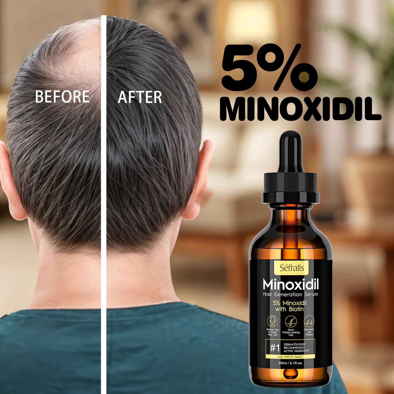 5% Minoxidil Hair Growth Serum Oil For Men and Women, Biotin Hair Serum, Safest Hair Regrowth Treatment, Prevent Scalp Hair Loss 60ml / 2.11 fl.oz