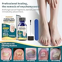 Vista 3 de Tratamiento de hongos en las uñas de los pies, tratamiento de hongos en las uñas extra fuerte para uñas, amarillas, decoloradas, uñas rotas