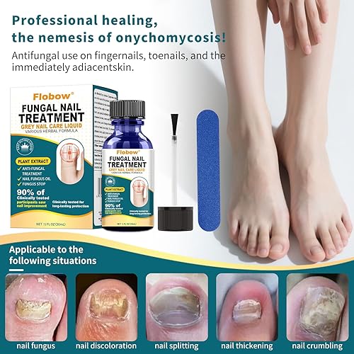 Miniatura 3 de Tratamiento de hongos en las uñas de los pies, tratamiento de hongos en las uñas extra fuerte para uñas, amarillas, decoloradas, uñas rotas y