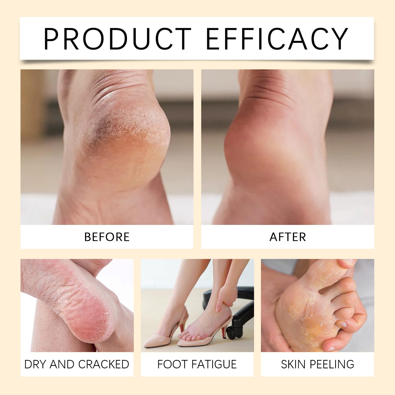 Spray Peeling per Calli e Idratante Nutriente Peel Off - Esfoliante Istantaneo per Piedi