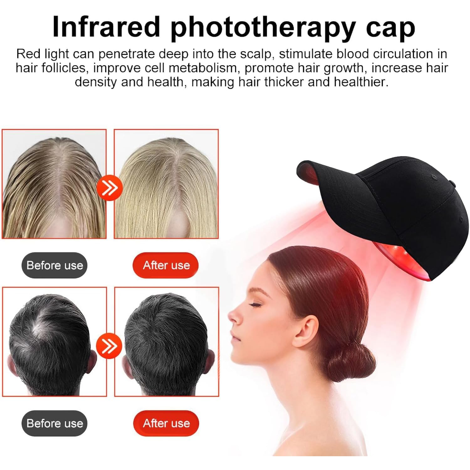 Gorro de Crecimiento del Cabello con Terapia de luz roja, Dispositivo de Terapia de 660 NM y 850 NM para el Crecimiento del Cabello, 82 LED, restaura el Grosor del Cabello y Reduce la caspa