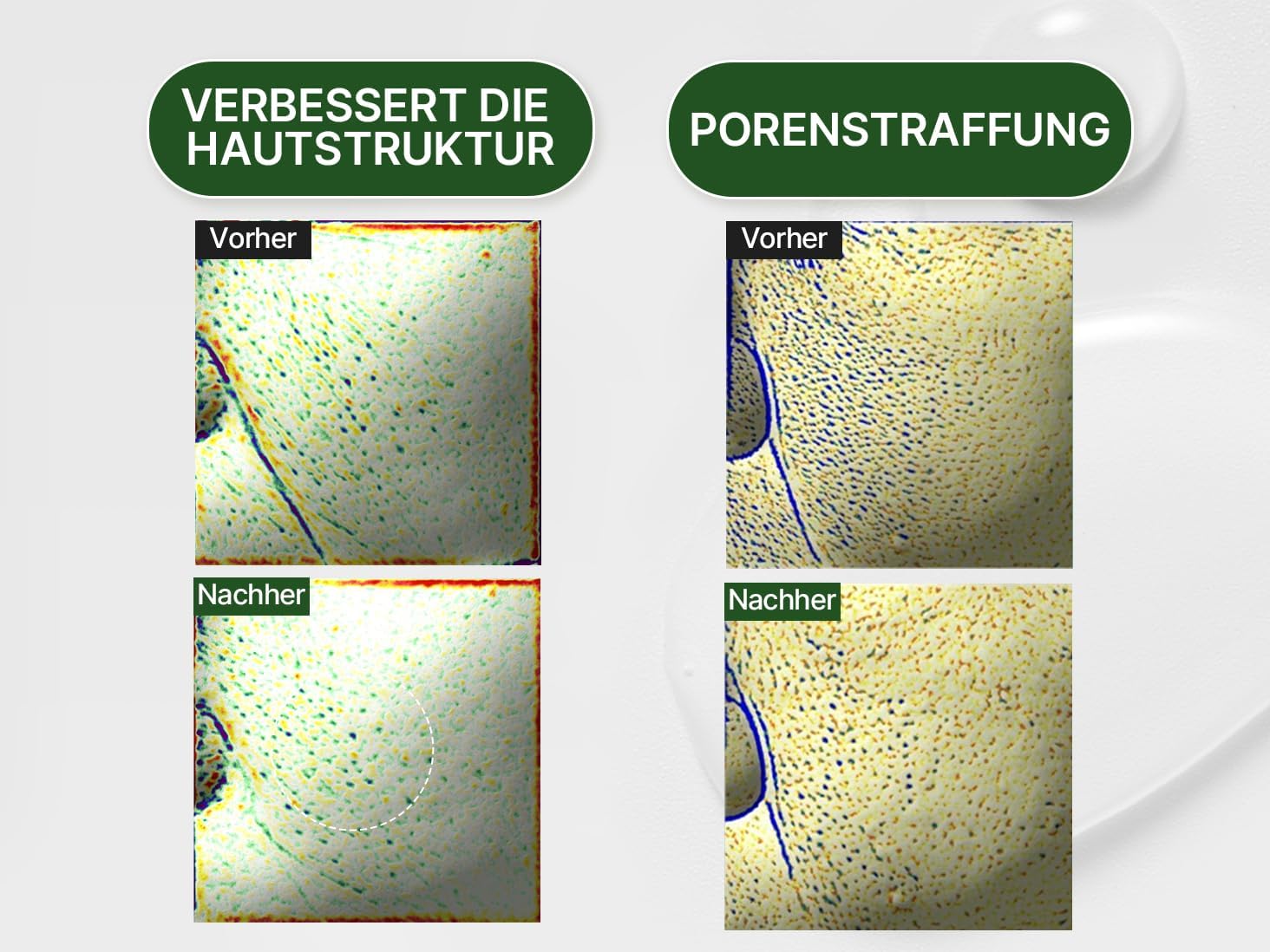 HAMEL Glow 12GF Hyal Essence Toner, Cooling & Moisturizing Booster, Pore Tightening & Radiant Glow with Peptides & 10,000ppm of Hyaluronic Acid, Unscented, Vegan, Cruelty Free, 6.76 fl.oz. - Image 6