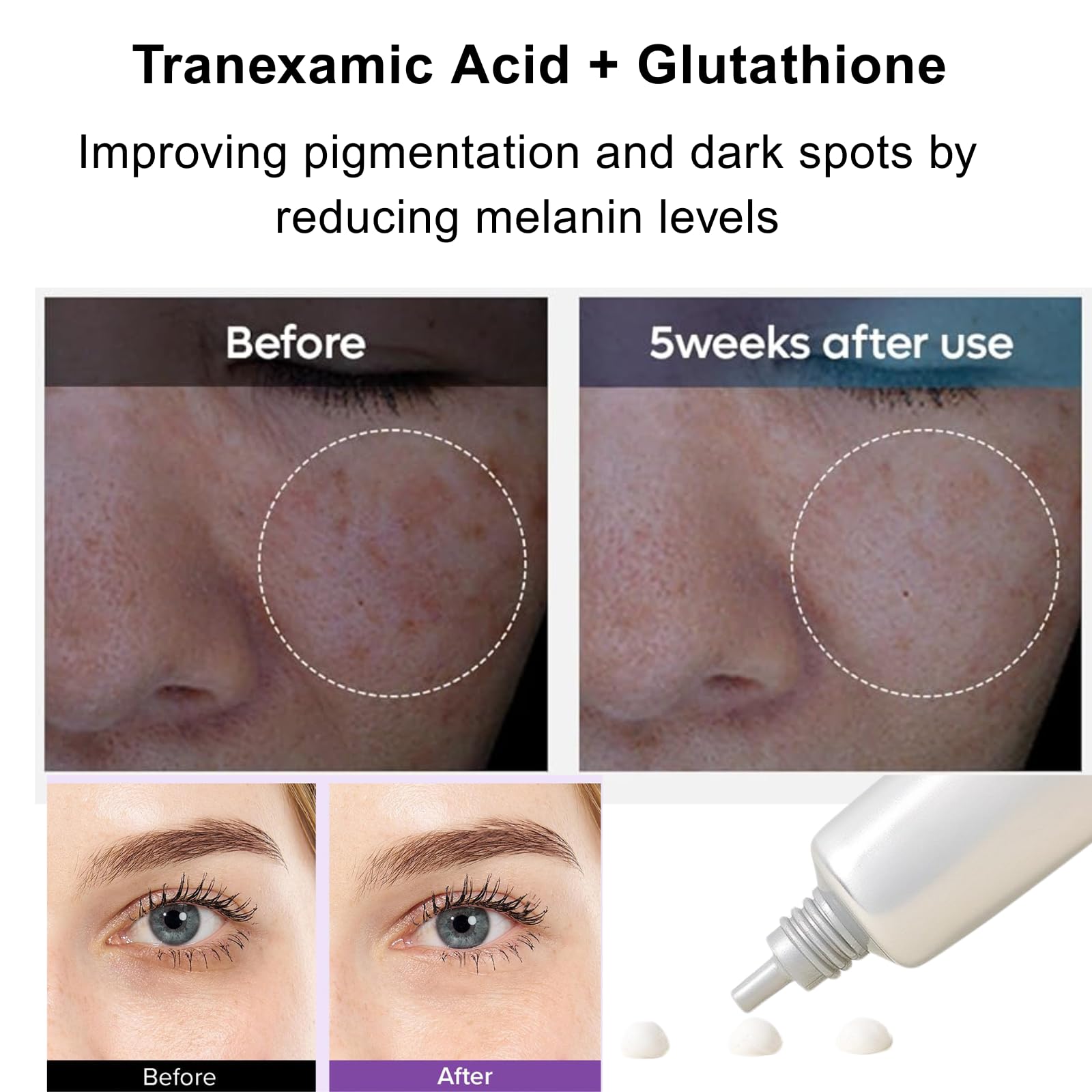 glutathione for eyesight Tranexamic Acid + Glutathione Eye Cream,Powerful Antioxidant, With Vitamin  C Eye Creams,Reduces Dark Circles And Puffy Eyes,Uneven Skin Tone Wrinkle  Filler Korean Eye Cream,30ml : Amazon.co.uk: Beauty