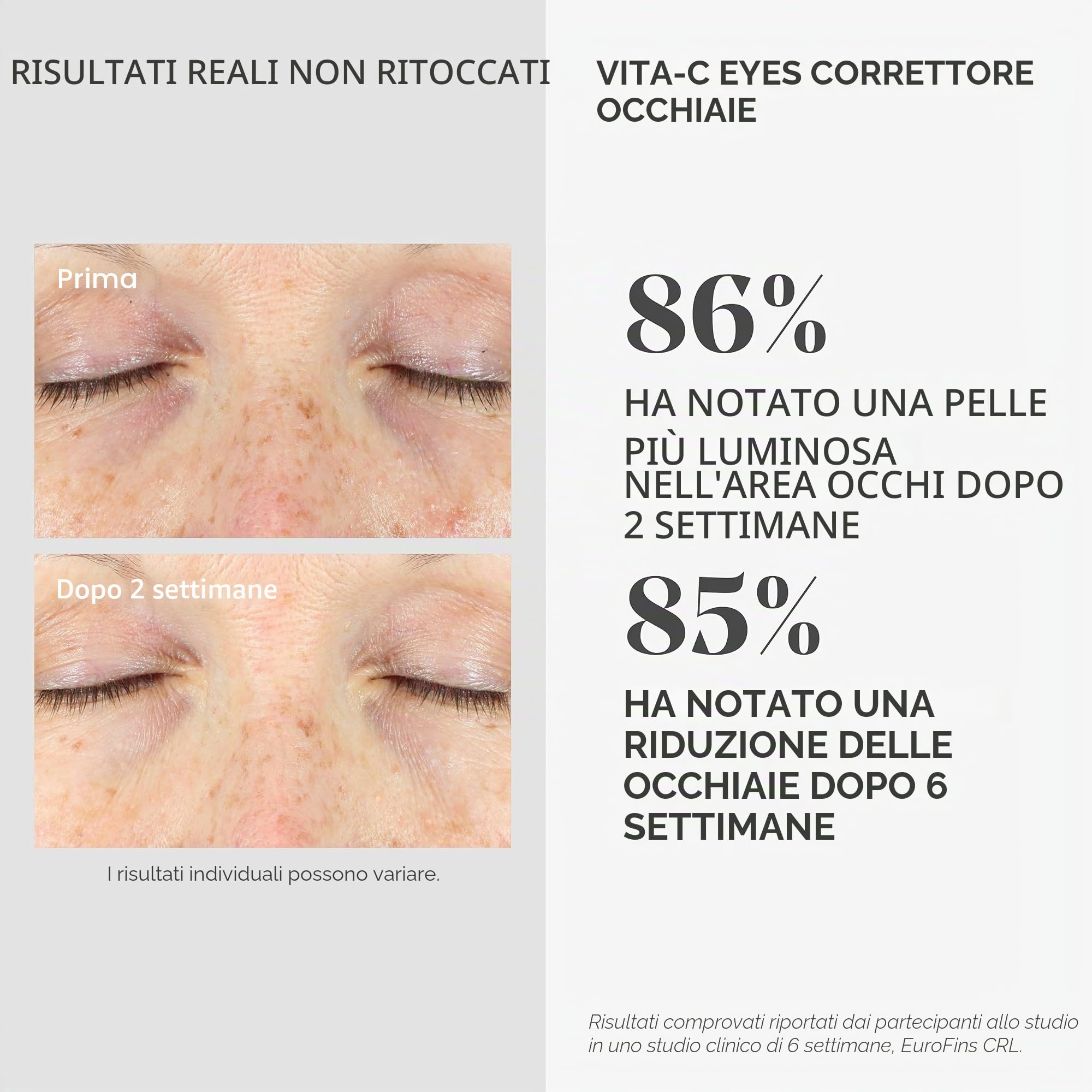 Murad - Vita-C Eyes Dark Circle Corrector 15 ml