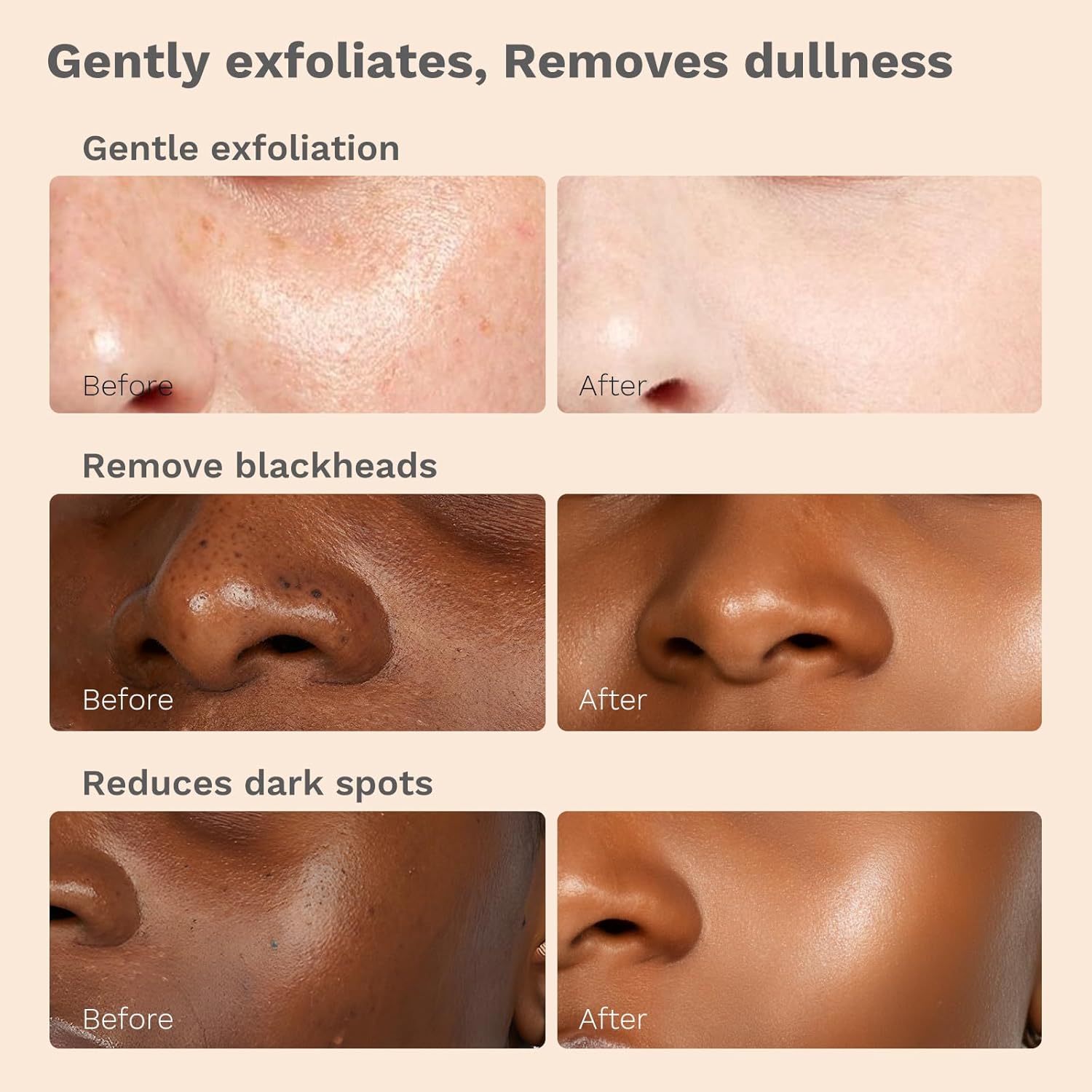 APoEM Renew & Purify Skincare Set | Anti-Aging Serum Capsules & Tea Tree Face Scrub | Smooth, Firm & Brighten Skin | Natural Botanical Formula - Image 4