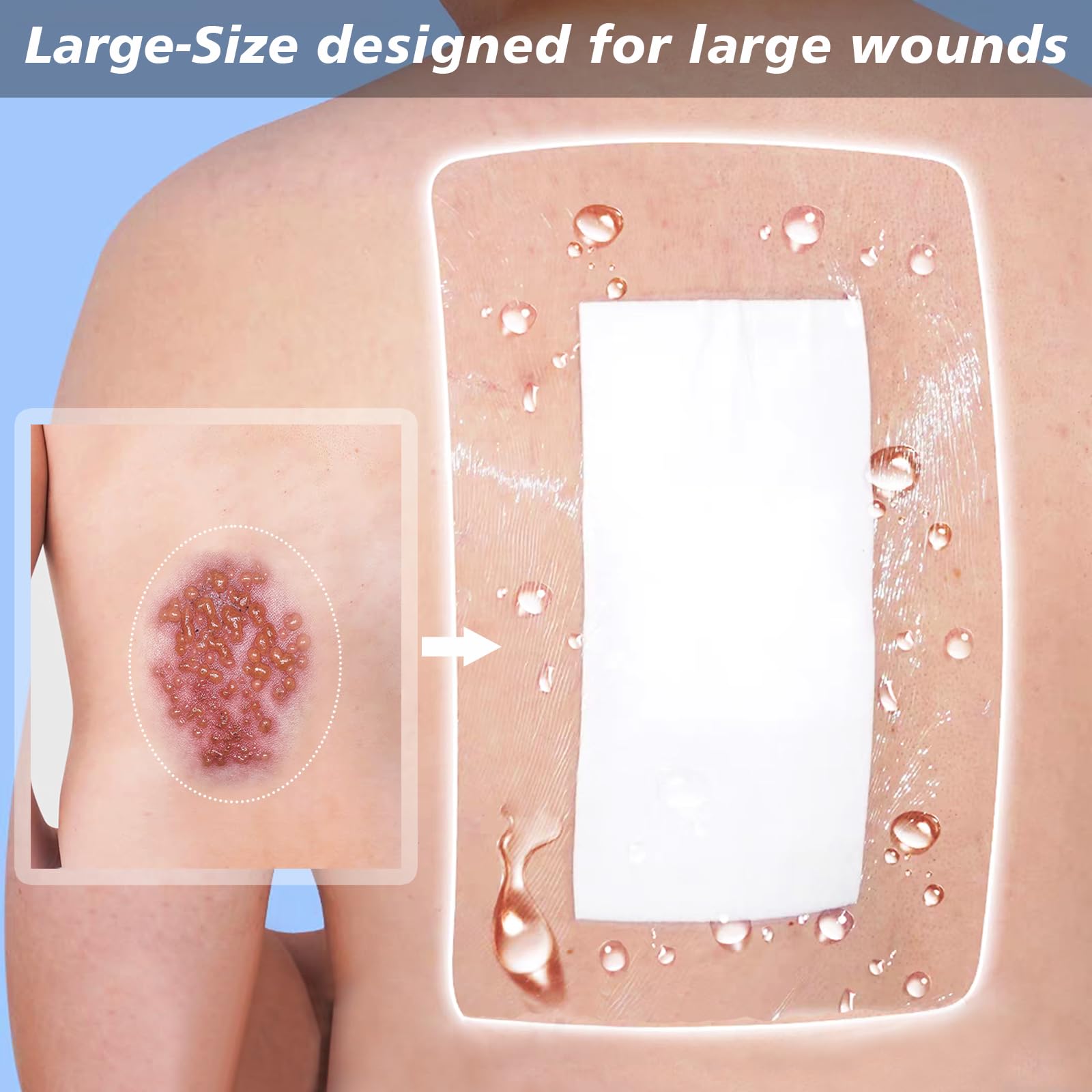 20Pcs Adhesive Island Dressing 4" X 4" For Dialysis Catheter Chemo Port Tummy Tuck Incision Covers Chest Patch Gauze Pads Drain C-Section Wound Bandage Protector Knee Hip Replacement
