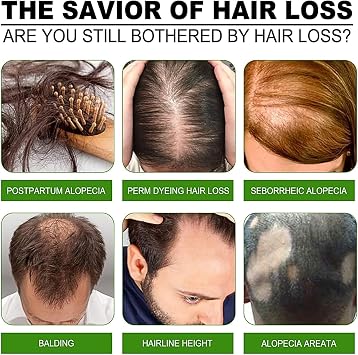 Micro-Infusion Hair Regrowth System, Hair Regrowth Dry Scalp Serum, Micro Infusion Hair Growth Serum Kit for Thinning Hair Filler & Scalp Care & Hair Thickening Wrinkle Filler for Men & Women