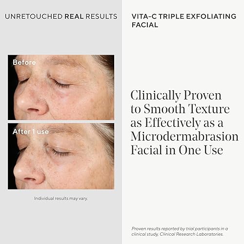 Miniatura 3 de Murad Environmental Shield Vita-C Triple Exfoliante Facial – Exfoliante Facial Exfoliante con Vitamina C Estabilizada Oro Antioxidante – Suavizante