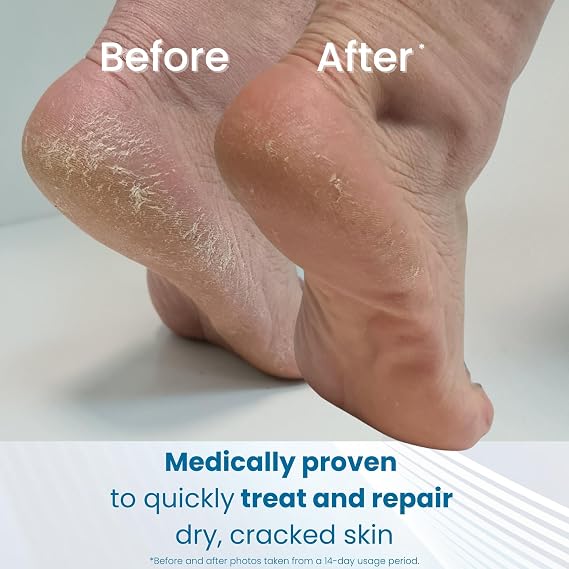 Flexitol Heel Balm (56g)