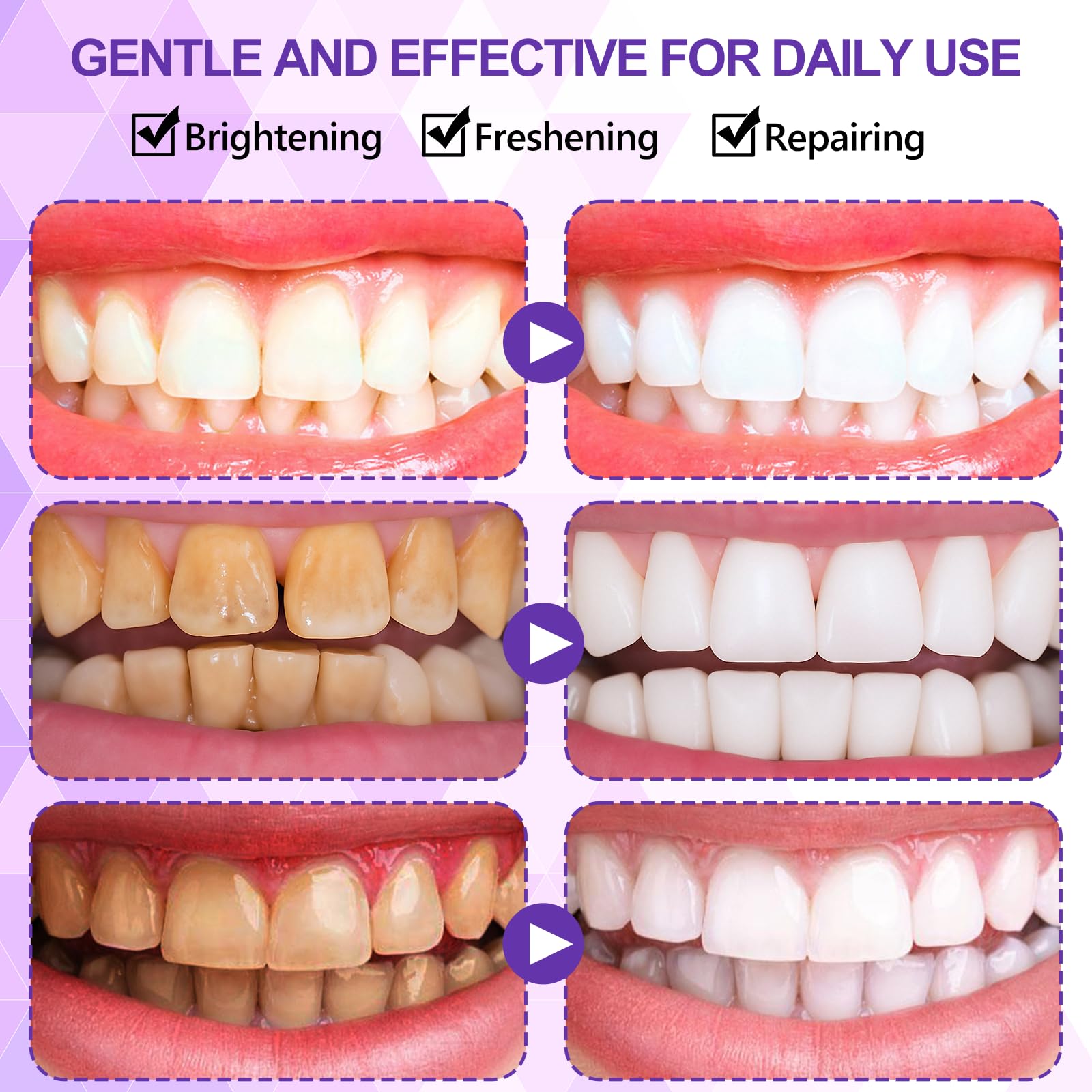 14 Piezas Tiras Blanqueadoras Moradas, Whitening Strips, Blanqueador Dental Profesional Teeth Whitening Strips, Para El Café Y Otras Manchas, Refresca RespiracióN - 5