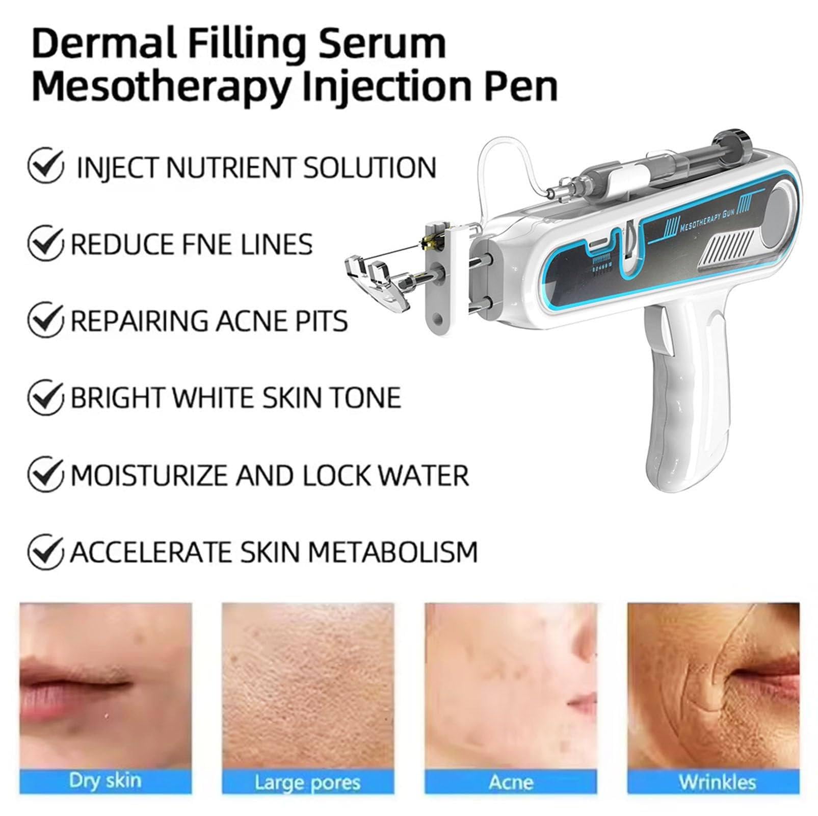 メソガン　EMS＋RF mesogun メソガン EMS＋RF mesogun Needle Free Mesotherapy Machine With EMS