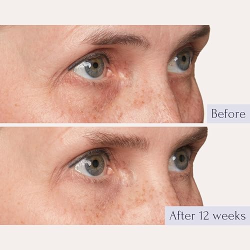 Miniatura 3 de Tru Alchemy Eye Elixir Crema refrescante para el tratamiento de ojos, crema de ojos de círculo oscuro para hinchazón y bolsas debajo de los ojos,