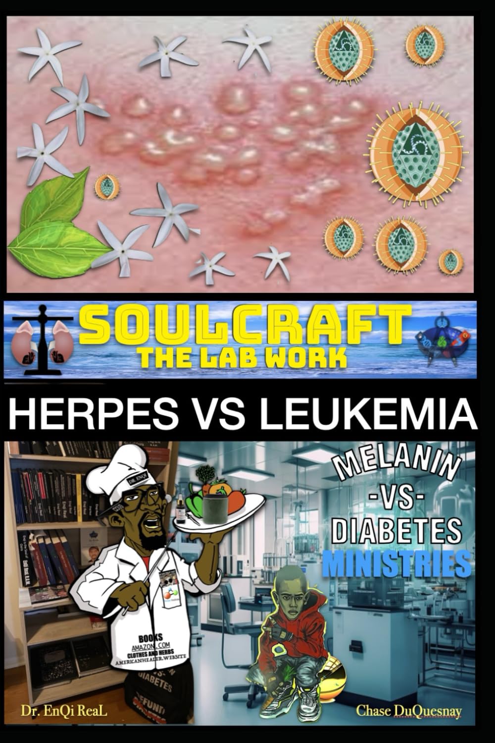SoulCraft the Lab Work: Herpes vs Leukemia (TRUE & LIVING KEMETIC SCIENCE)