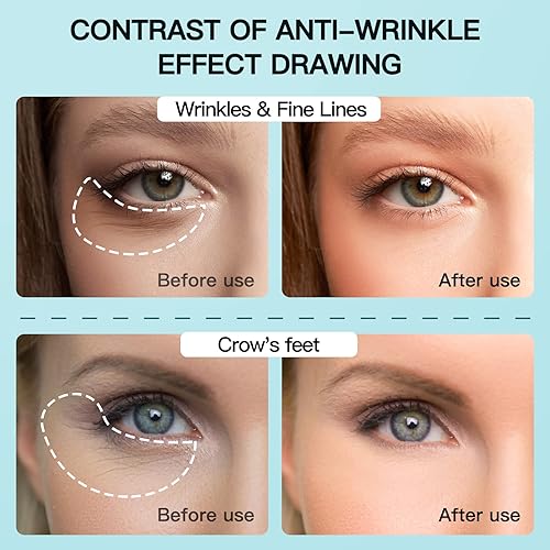 Miniatura 3 de JUUPLE Microcurrent Facial Device, Eyes Skin Tightening, Anti Aging Device, Eye Bags, Eye Puffiness