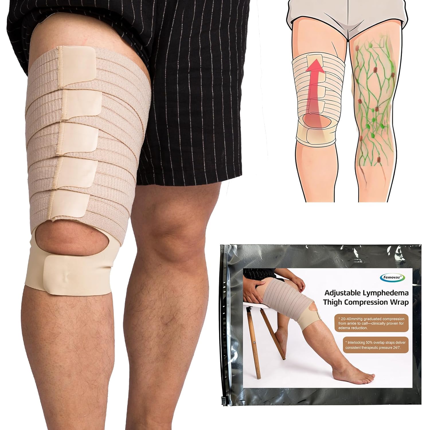 Femovaz® 1PC Thigh Compression Wrap + Compression Knee Kit | Relieves Swelling, Edema, Lipedema | Breathable | Anti-Slip | All-Day Comfort,L