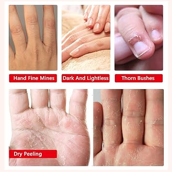 AIQIUSHA 4 Pack Hands Moisturizing Gloves, Hand Spa Mask Infused Collagen, Serum + Vitamins + Natural Plant Extracts for Dry, Cracked Hands, Moisturizer Hands Mask, Repair Rough Skin for Women&Men