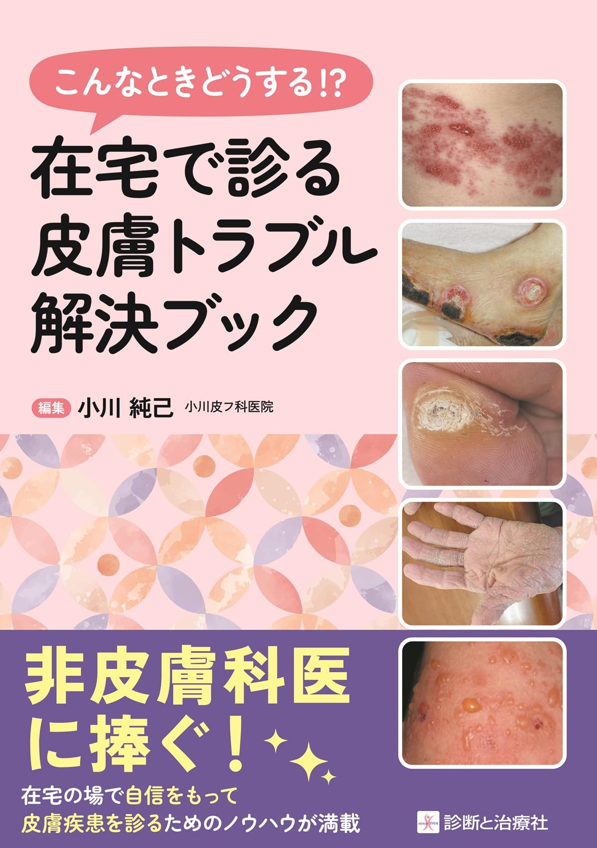 こんなときどうする!? 在宅で診る皮膚トラブル解決ブック | 小川 純己