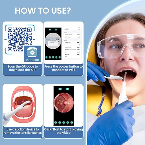 Miniatura 7 de Removedor de piedras amígdalas con cámara, kit electrónico de eliminación de piedras amígdalas con luz LED, 3 niveles de succión, combate el mal