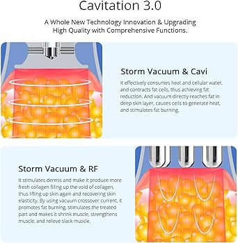 Amazon.co.jp: ボディシェイピングマシン、40K超音波キャビテーション