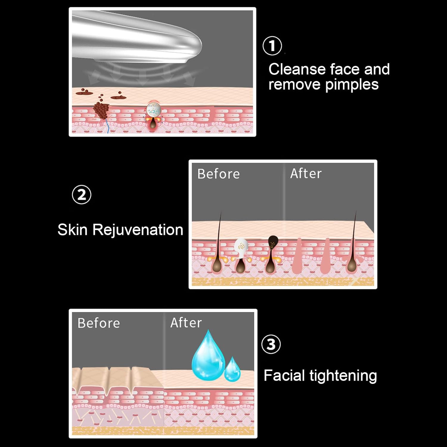 Skin Rejuvenation Machine Facial Beauty Machine Face Lift Wrinkle Removal Portable Pink Eye Face Skin Care Machine Portable Skin Machines : Beauty & Personal Care