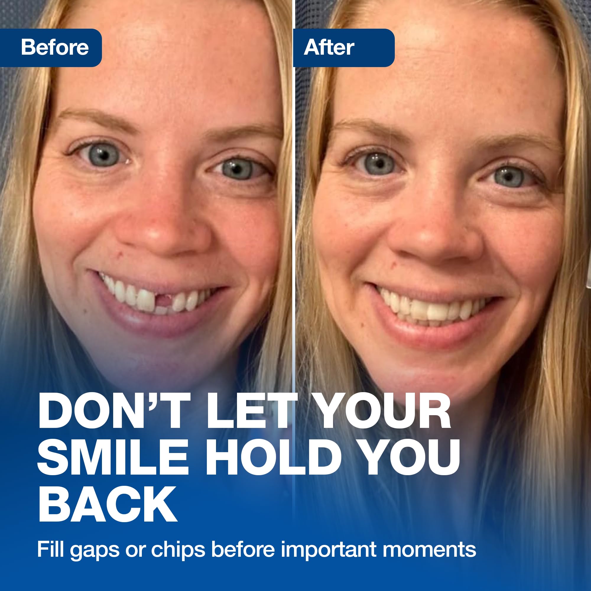 Imako Tooth Tint - Temporary Fake Tooth -4