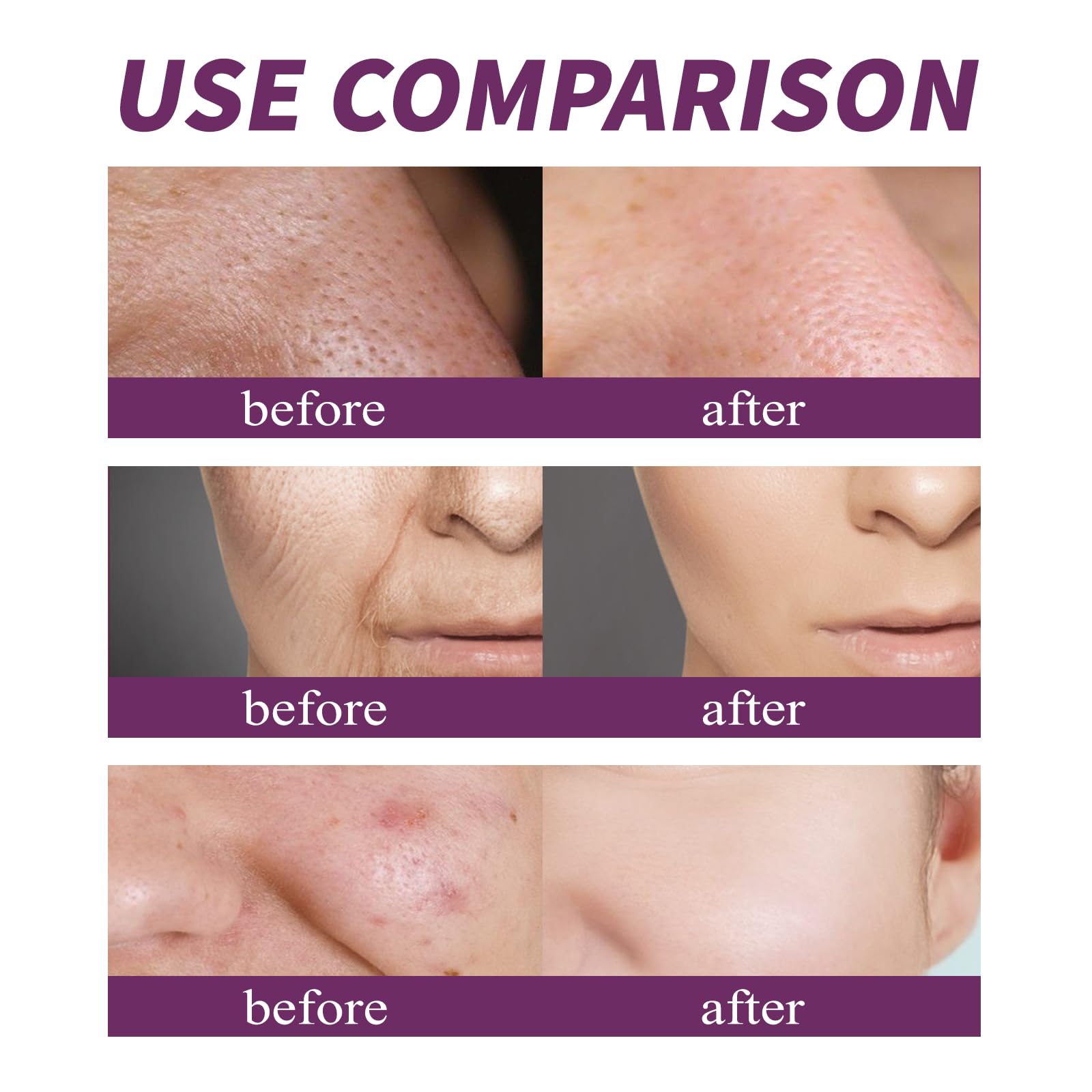 Niacynamid 20% serum do twarzy, rozjaśniające, poprawia elastyczność, nawilża, przeciwzmarszczkowe, wygładza cerę, wygładza drobne linie, zmniejsza pigmentację (12 szt.)