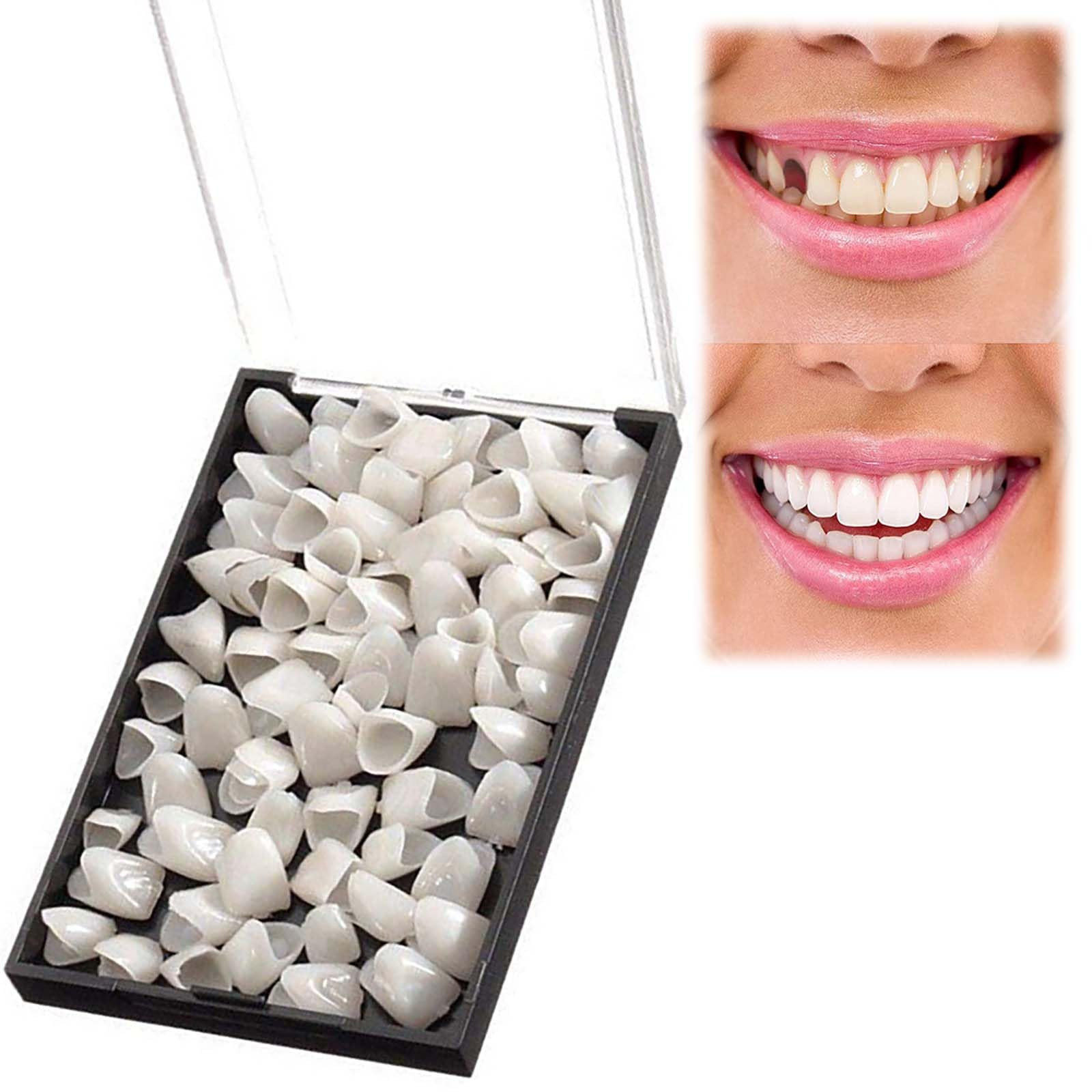 70-Piece Temporary Crown Kit for Teeth Revitalize - Including Prosthetic Front Teeth as Replacement Teeth, False Tooth, and Dental Revitalize Crowns - Ideal for Anterior Teeth Oral Care